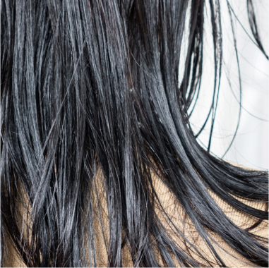 Oily Scalp