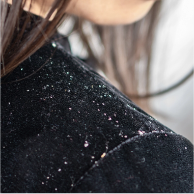 Dandruff